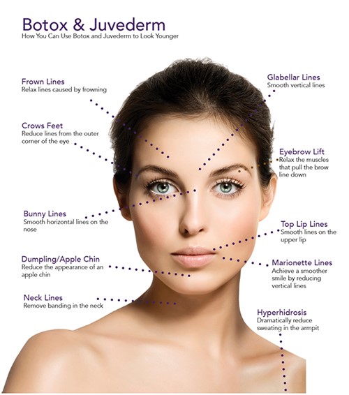 Rejuvenare faciala – Tratamentul ridurilor cu toxina botulinica